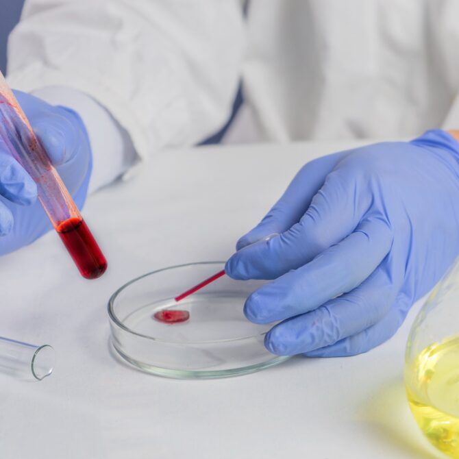 Hematologia i serologia grup krwi